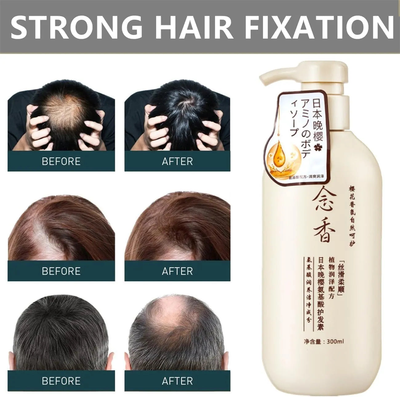 Sakura Japanese Shampoo For Hair Loss || شامبو ساكورا الياباني لعلاج تساقط الشعر