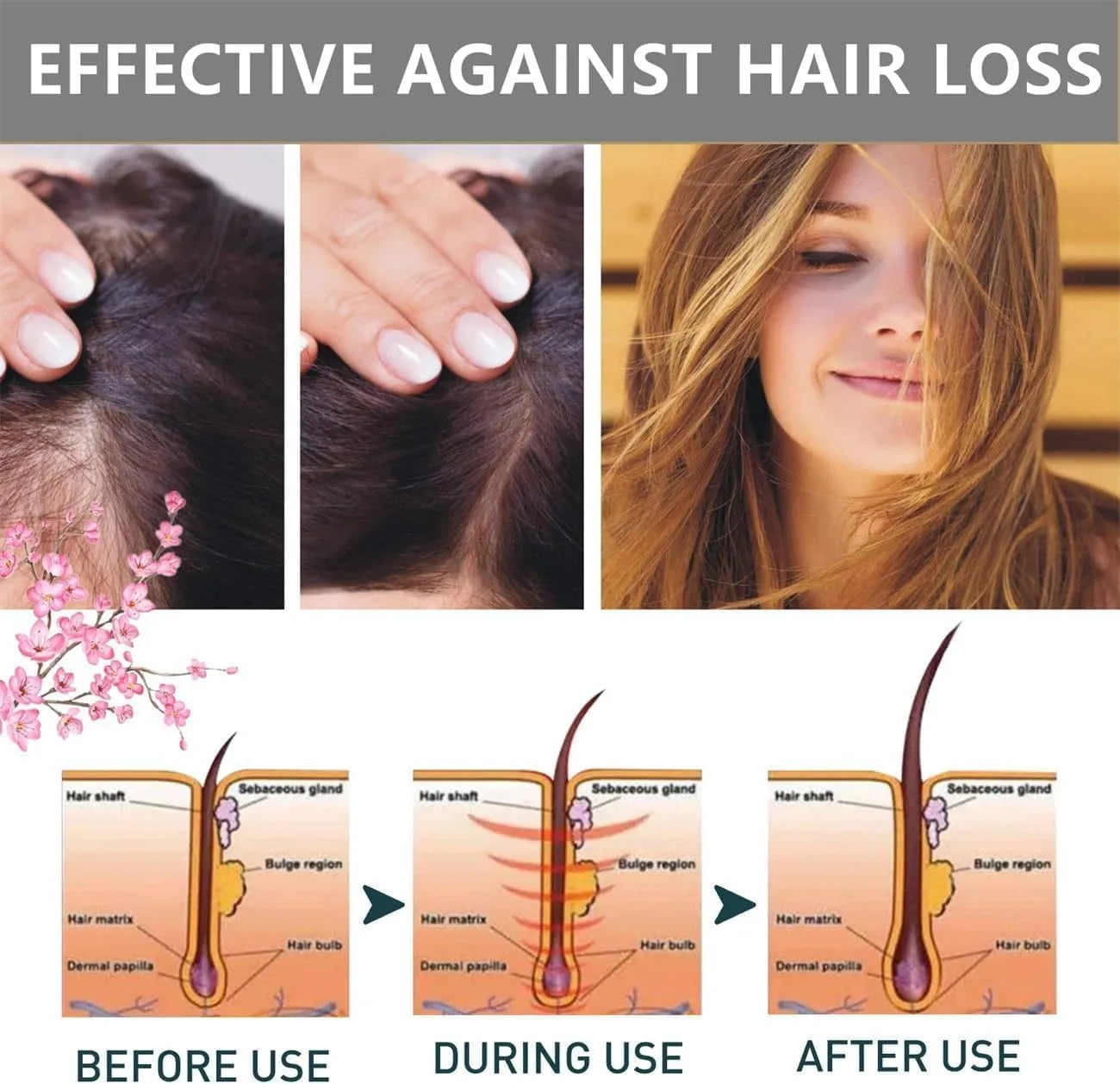 Sakura Japanese Shampoo For Hair Loss || شامبو ساكورا الياباني لعلاج تساقط الشعر